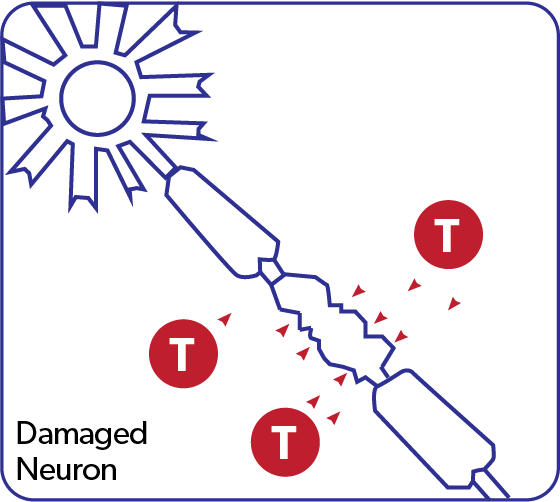 Damaged Neuron